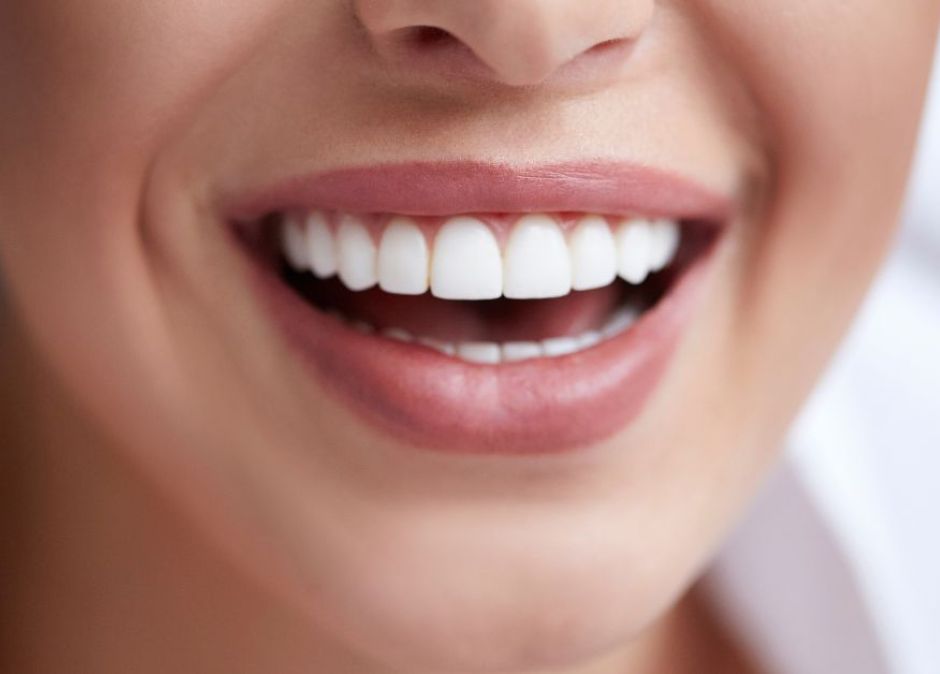 Teeth Whitening Peabody MA
